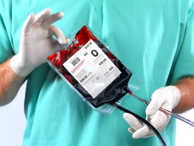 Lekarz trzymający worek z krwią